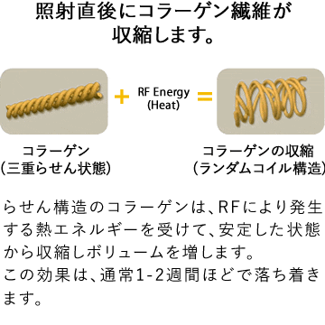 効果のメカニズム初期効果　コラーゲンが収縮しているイラスト