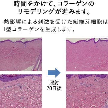 効果のメカニズム2次効果　画像